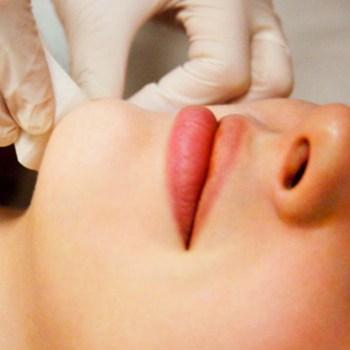 Wax Chin