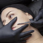 Dermaplaning exfoliation